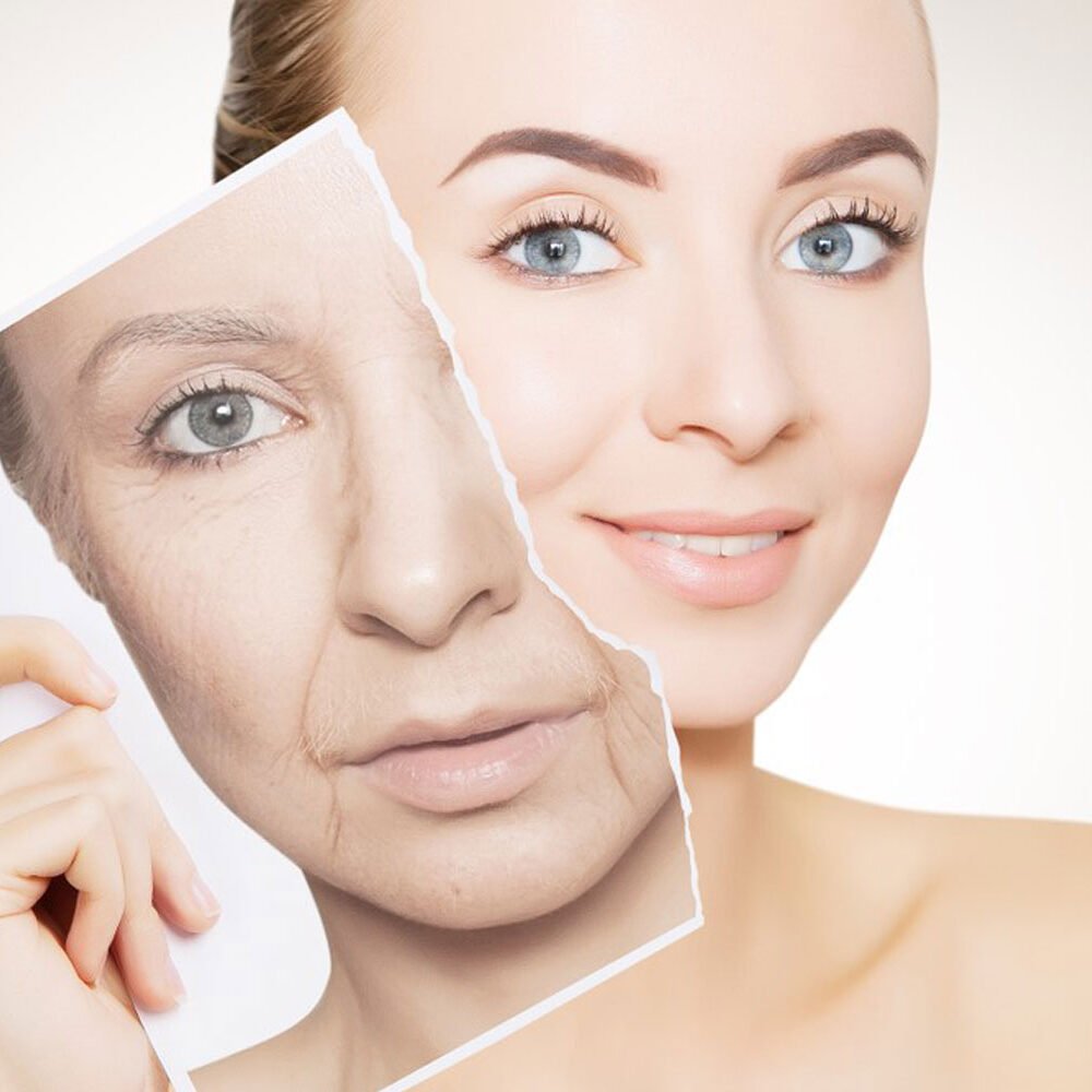 Anti-Aging Treatment in Bhopal showing facial rejuvenation and wrinkle reduction by Dr. Prerna Sharma, Dermatologist and Skin Specialist in Bhopal.