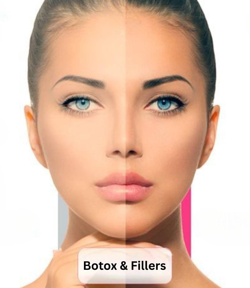 Botox and Dermal Fillers Treatment in Bhopal for wrinkle reduction, facial rejuvenation, and youthful skin by Dr. Prerna Sharma, Dermatologist in Bhopal.